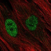 Anti-MT1E antibody produced in rabbit 
