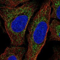 Anti-MTERF1 antibody produced in rabbit 