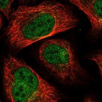 Anti-MTFMT antibody produced in rabbit 