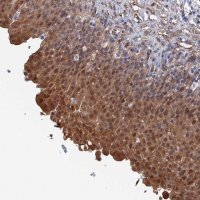 Anti-MTHFSD antibody produced in rabbit 