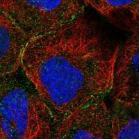 Anti-MTHFSD antibody produced in rabbit 