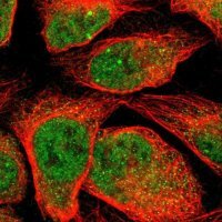 Anti-MTMR10 antibody produced in rabbit