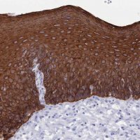 Anti-MTMR2 antibody produced in rabbit 