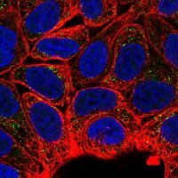 Anti-MTMR2 antibody produced in rabbit 