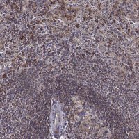Anti-MTSS1 antibody produced in rabbit