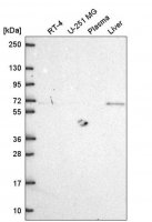 Anti-MTSS1 antibody produced in rabbit