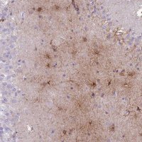 Anti-MTSS1L antibody produced in rabbit
