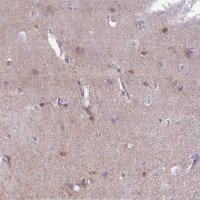 Anti-MTSS1L antibody produced in rabbit