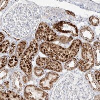 Anti-MTX2 antibody produced in rabbit HPA031552-100UL
