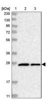Anti-MTX2 antibody produced in rabbit HPA031552-100UL