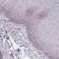 Anti-MUS81 antibody produced in rabbit HPA059530-100UL