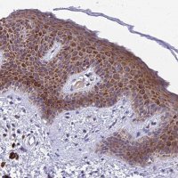 Anti-MVB12A antibody produced in rabbit 