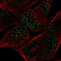 Anti-MYCL antibody produced in rabbit HPA063132-100UL