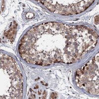 Anti-N4BP1 antibody produced in rabbit