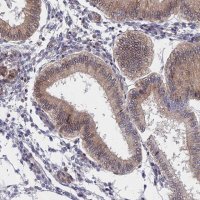 Anti-NAA10 antibody produced in rabbit 