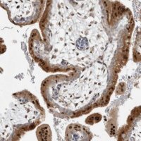 Anti-NAB2 antibody produced in rabbit 