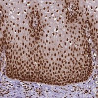 Anti-NACC1 antibody produced in rabbit