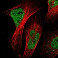 Anti-NACC1 antibody produced in rabbit
