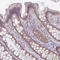 Anti-NACC2 antibody produced in rabbit