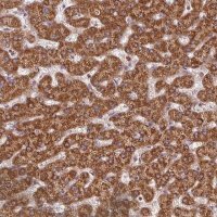 Anti-NADK2 antibody produced in rabbit 