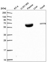 Anti-NARF antibody produced in rabbit