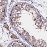 Anti-NAT6 antibody produced in rabbit