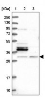 Anti-NAT6 antibody produced in rabbit