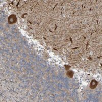 Anti-NAV2 antibody produced in rabbit 