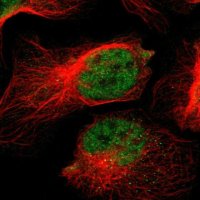 Anti-NAV2 antibody produced in rabbit 