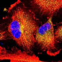 Anti-NBPF15 antibody produced in rabbit 