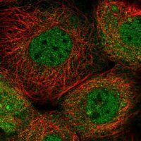 Anti-NCAPD2 antibody produced in rabbit HPA037363-100UL