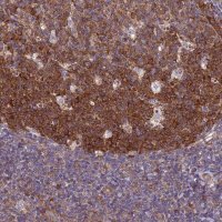 Anti-NCAPG antibody produced in rabbit 