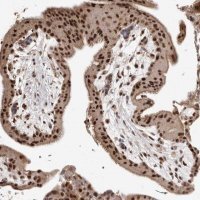 Anti-NCOA3 antibody produced in rabbit
