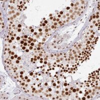 Anti-NCOA5 antibody produced in rabbit 