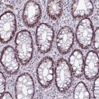 Anti-NCOR1 antibody produced in rabbit HPA050288-100UL