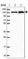 Anti-NCOR1 antibody produced in rabbit HPA050288-100UL