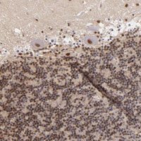 Anti-NCOR2 antibody produced in rabbit