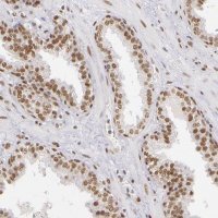 Anti-NCOR2 antibody produced in rabbit