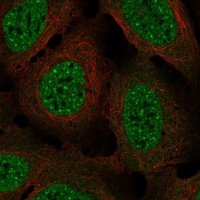 Anti-NDC80 antibody produced in rabbit 