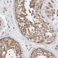 Anti-NDOR1 antibody produced in rabbit HPA024504-100UL