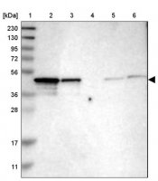 Anti-NDRG3 antibody produced in rabbit HPA018256-100UL
