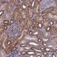 Anti-NDUFAF6 antibody produced in rabbit 