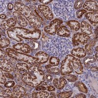 Anti-NDUFB9 antibody produced in rabbit HPA042768-100UL