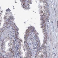 Anti-NDUFC2 antibody produced in rabbit HPA038873-100UL