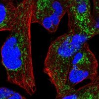 Anti-NDUFS1 antibody produced in rabbit 
