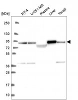 Anti-NDUFS1 antibody produced in rabbit 