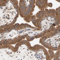 Anti-NECTIN3 antibody produced in rabbit 