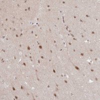 Anti-NEIL1 antibody produced in rabbit 