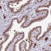 Anti-NEIL1 antibody produced in rabbit 