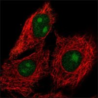 Anti-NEIL2 antibody produced in rabbit HPA064460-100UL